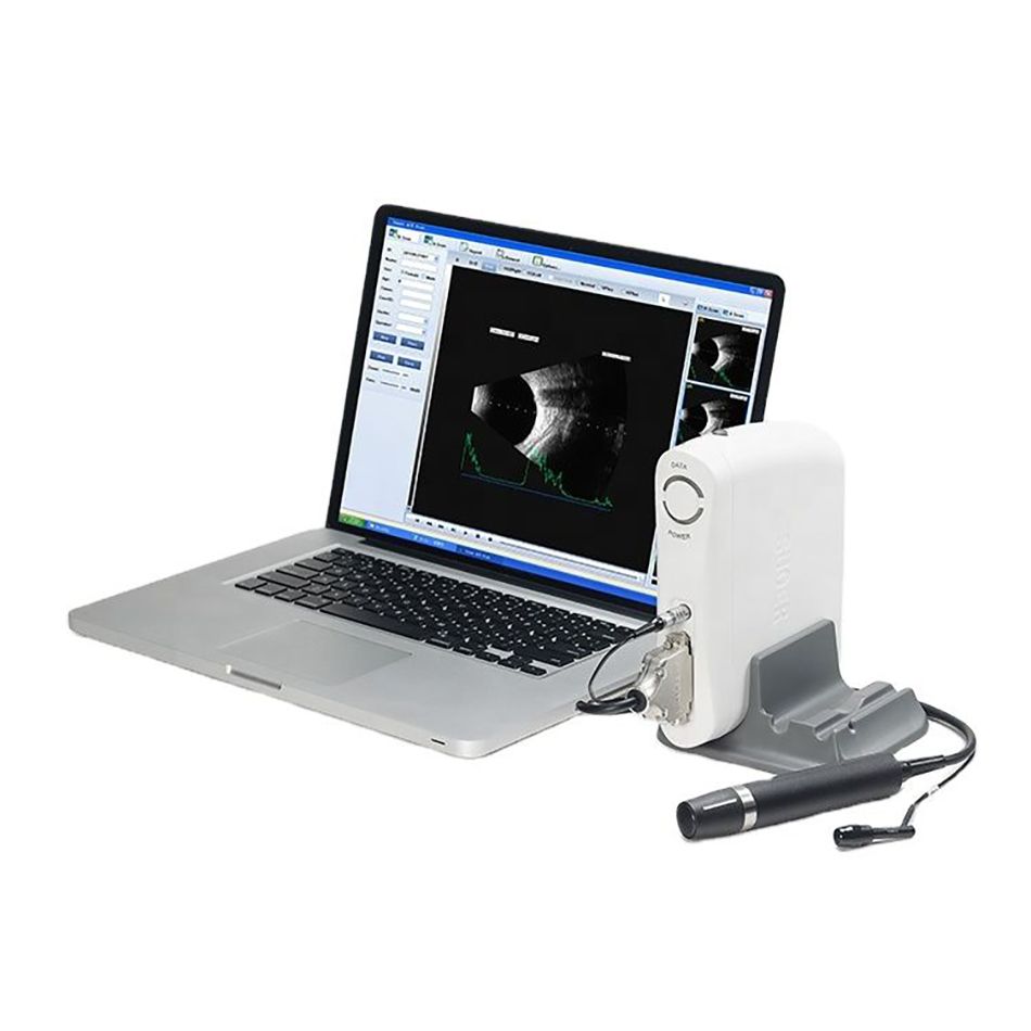 SW-2100 Ultrasound AB Scanner